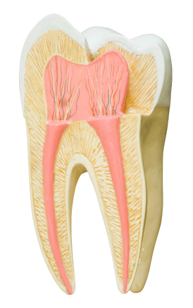 Treatment Options for Enamel Erosion