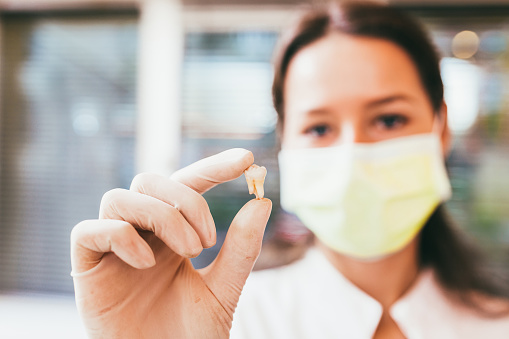 Dentist holding up extracted tooth at Dental Care of Burlington in Burlington, MA