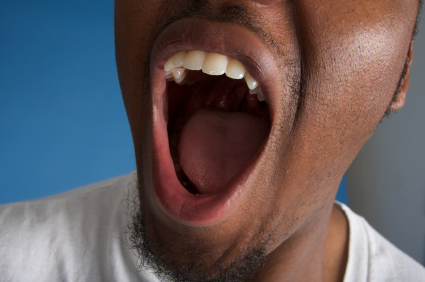 Image of a smiling man with an open mouth.